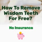 Remove Wisdom Teeth For Free - Frugal Reality